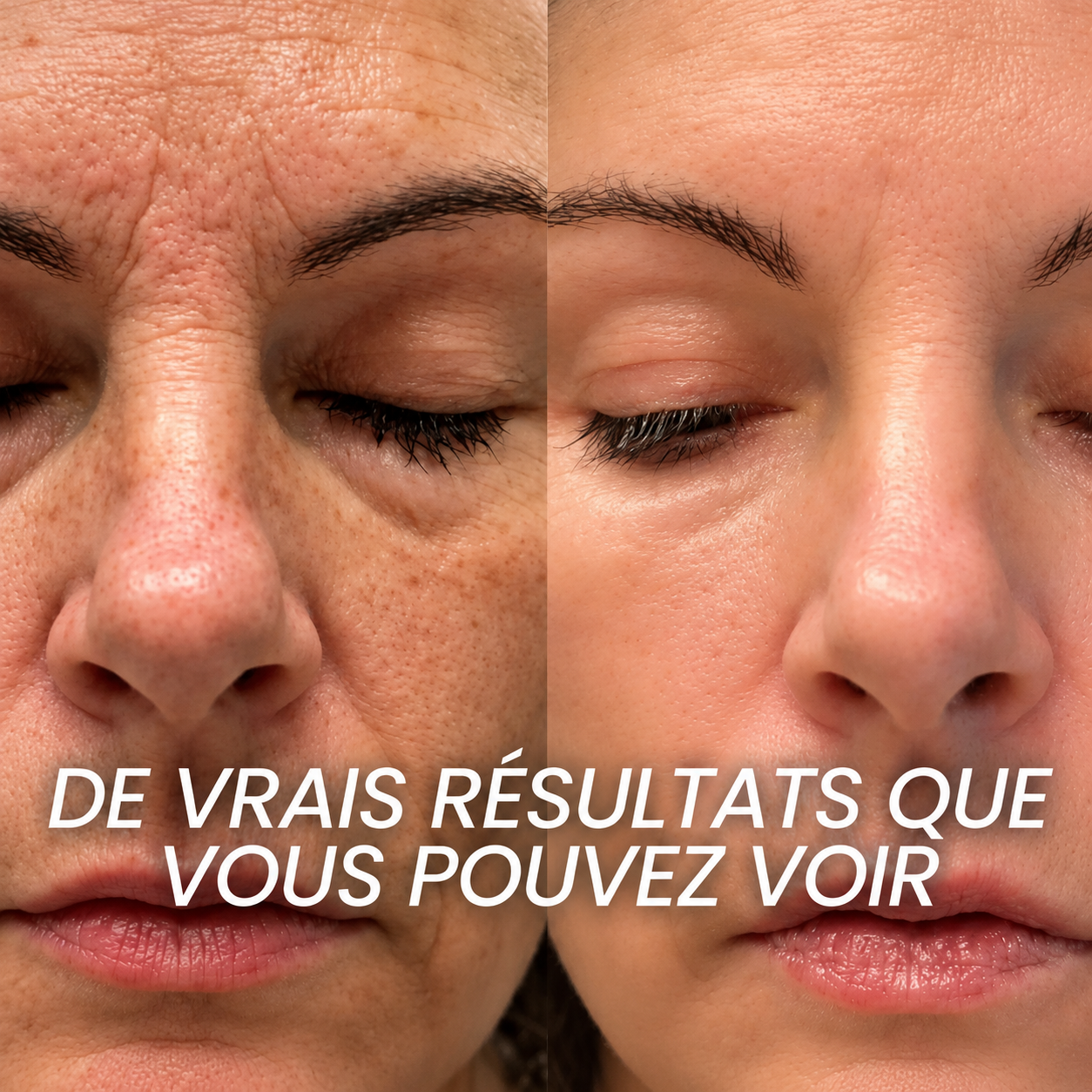Stick Repulpant Bio-Collagène PDRN